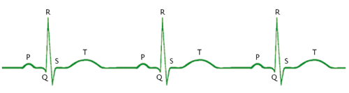 Normaal ECG